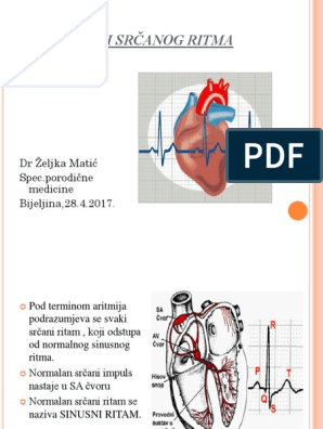 hipertenzije i srčanog ritma poremećaj